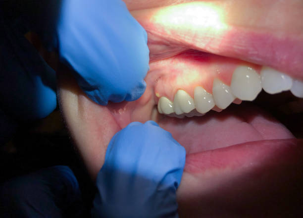 Best Emergency Treatment for Toothache in Elk Rapids, MI