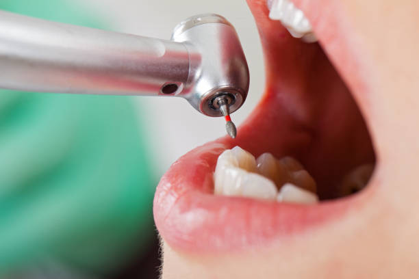 Best After-Hours Emergency Dentist in Elk Rapids, MI